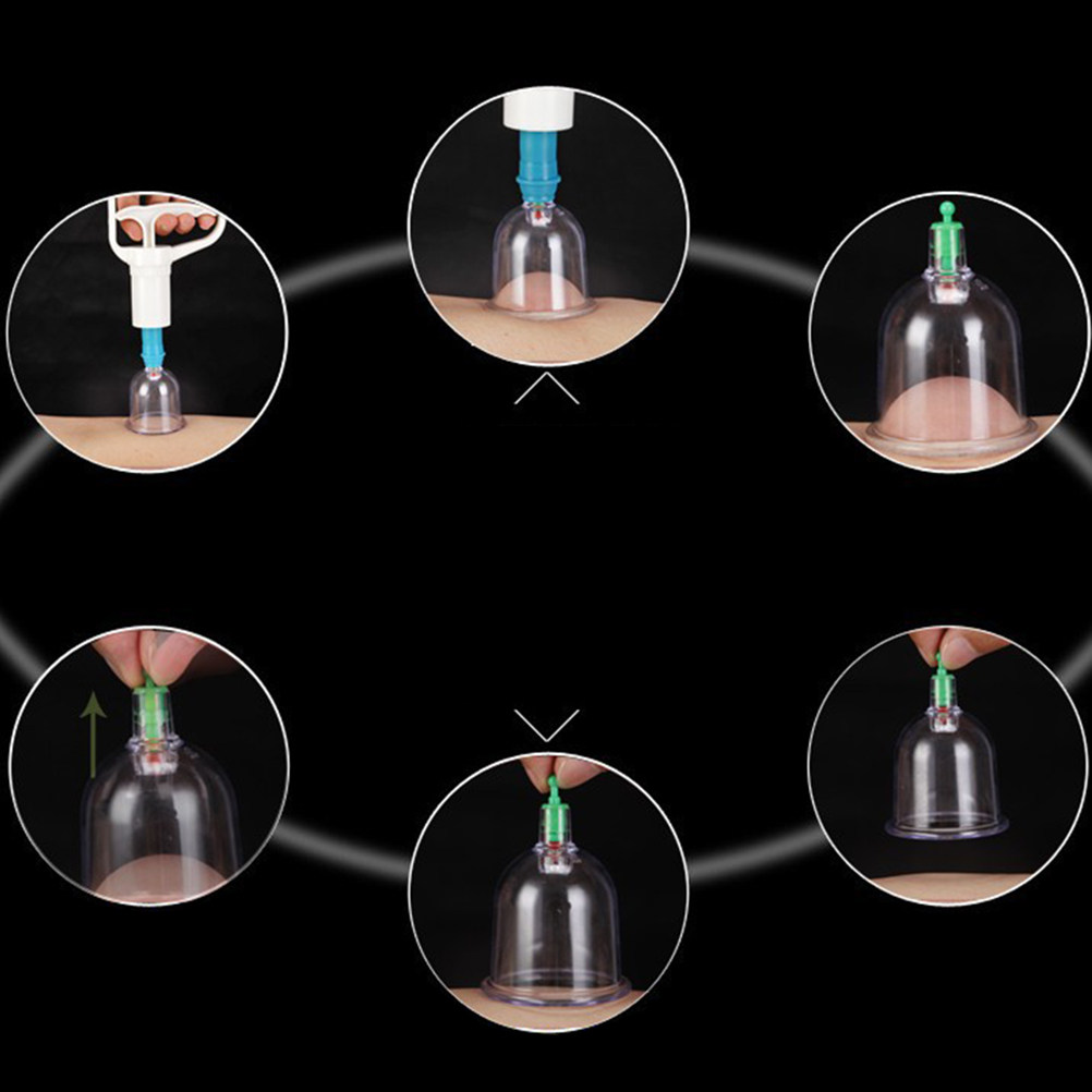 24 Vacuum Cupping Cups Kit Hom - Home Improvement Kit incelemesi ve fiyatı