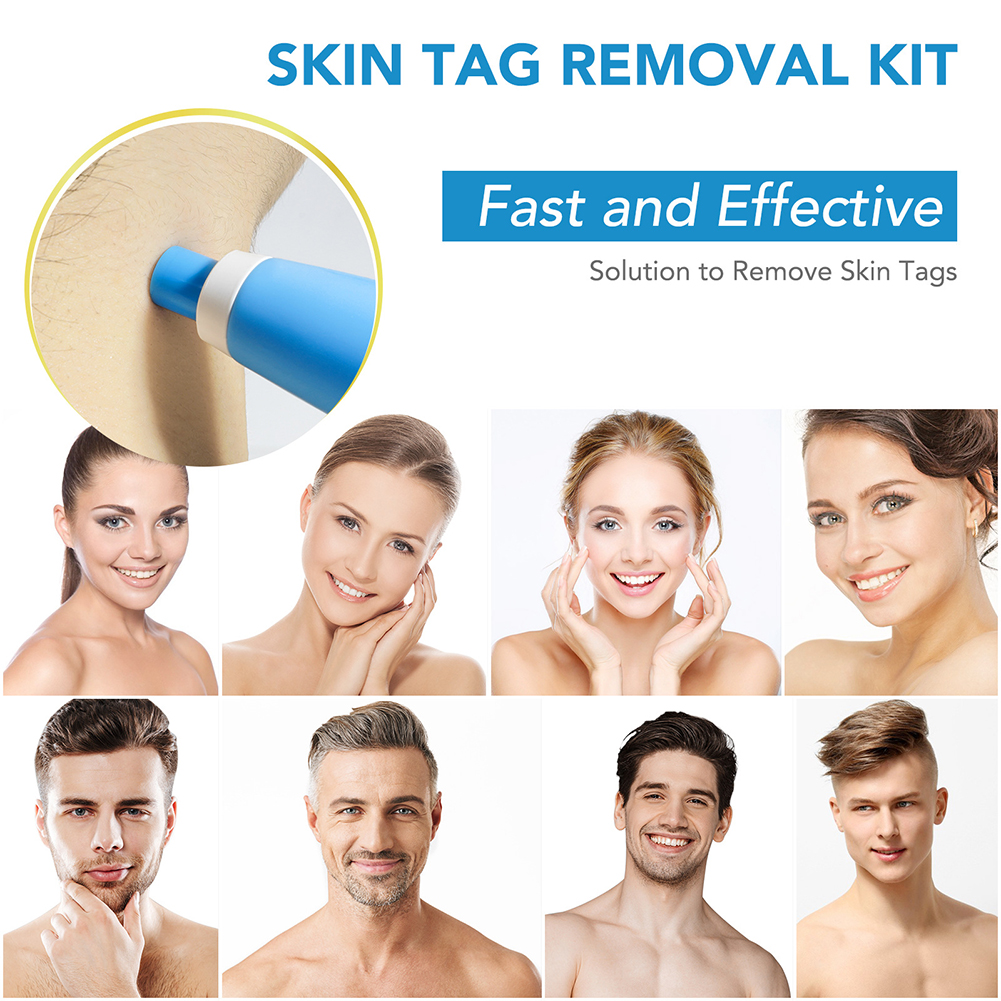2-IN-1 Auto Skin Tag Removal K - Home Improvement Kit incelemesi ve fiyatı